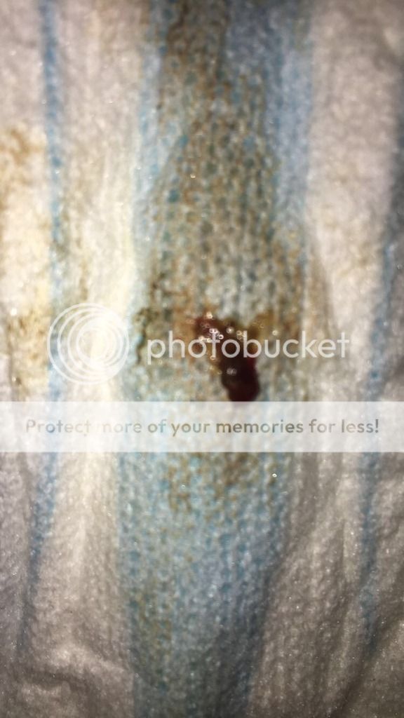 Mucus plug/bloody show or something else? (Pictures!) BabyCentre